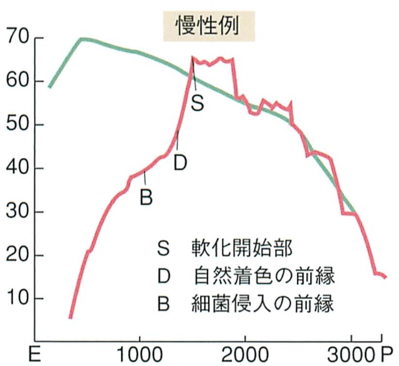 健常とう蝕時の象牙質の硬さ比較