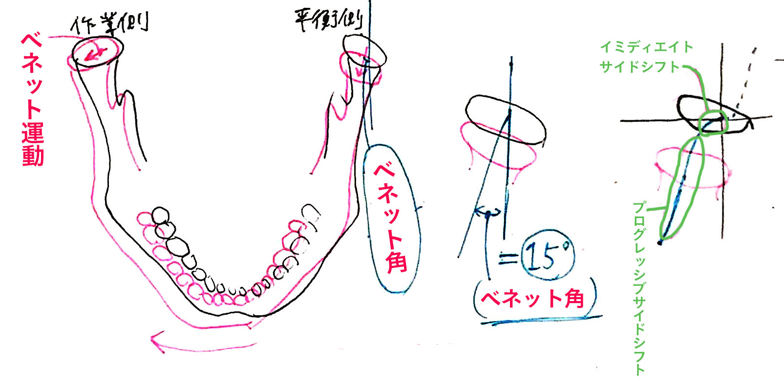 ベネット運動、ベネット角