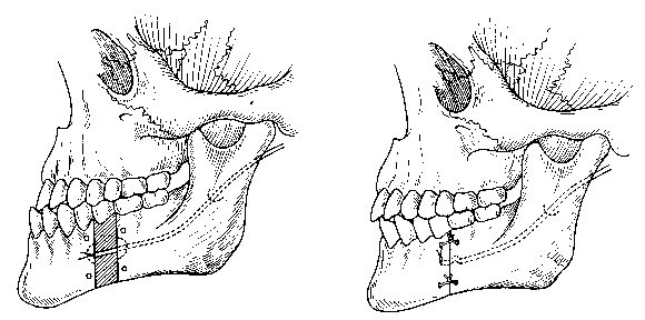 33274a4a-f947-4dc9-8d51-a1022718f1c4