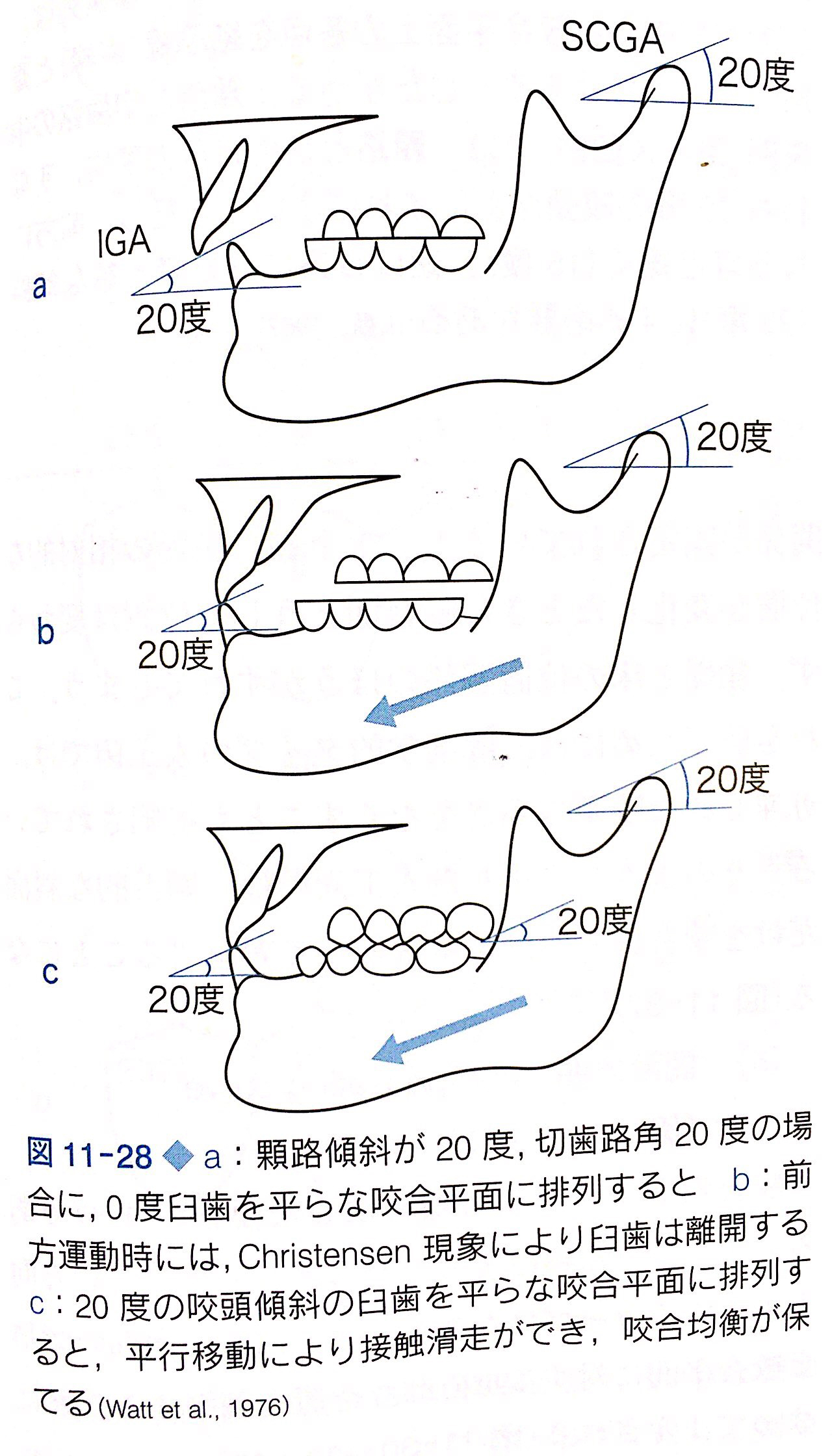 全部床義歯（フルデンチャー）、部分床義歯（パーシャル