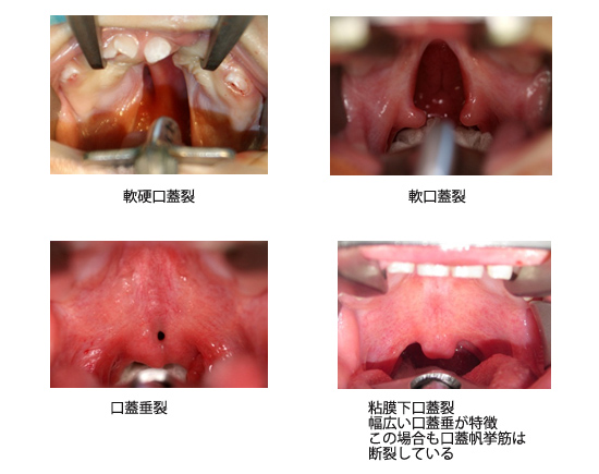 3C49BBAA 4582 4BDE A31F 3A54C7EEE12F