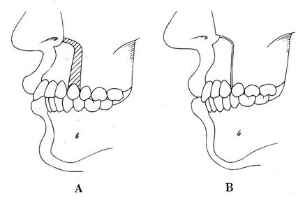85EFF4F7 B6E0 4346 80AA 9A97B8649093