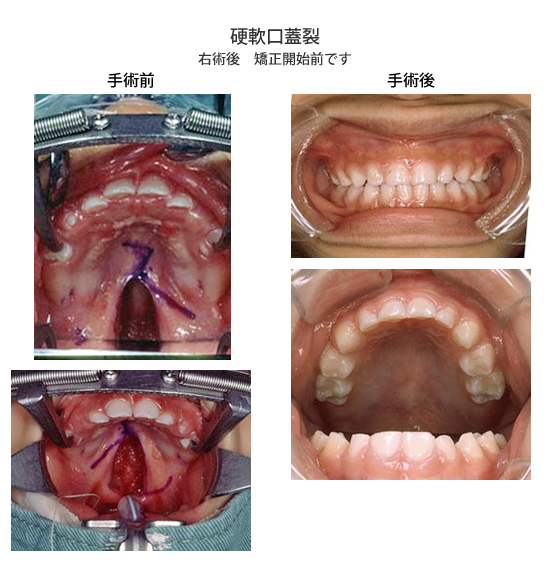 89D16152 5D9E 4C5B 88BB FFE18CD7EB1D