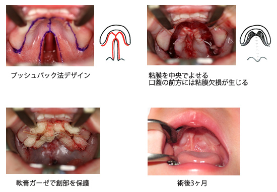 C9F7A92E 7A27 46F6 9742 1ABD82AE07AB