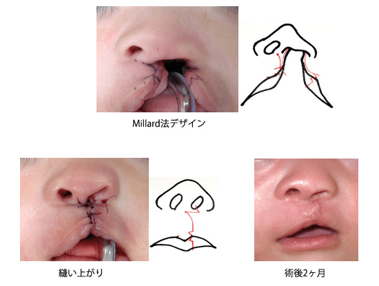 DAC9AAB0 406C 439C 96AD 317EDDF4CCEF