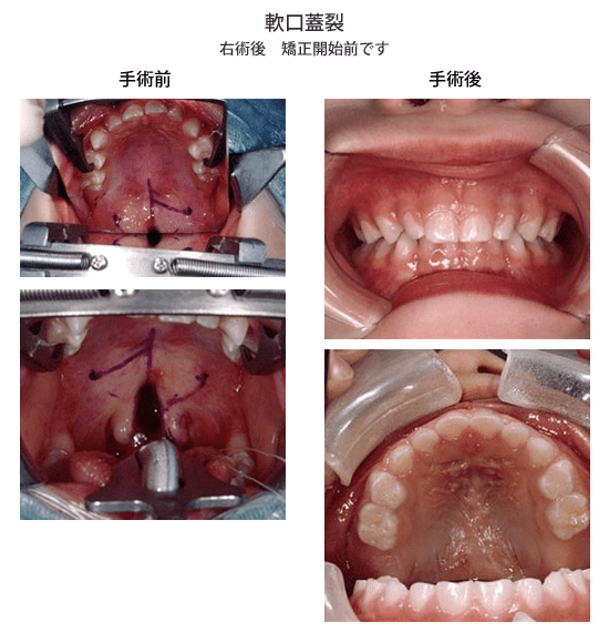 E90ADFDD 0E42 44C1 8E90 B8FD279AE501