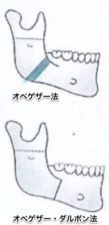 %e3%82%a4%e3%83%a1%e3%83%bc%e3%82%b7%e3%82%99