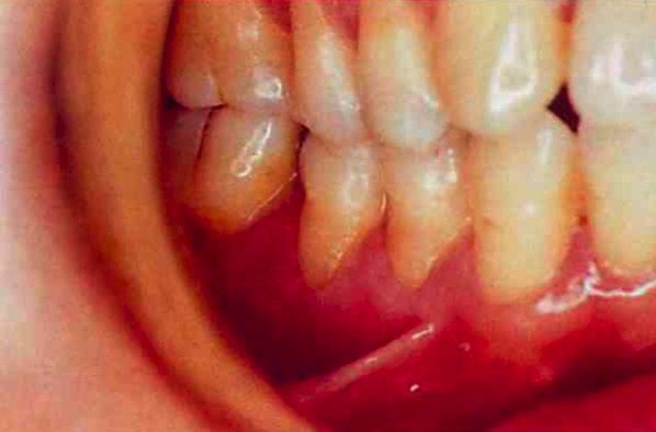 スクリーンショット 2016 12 08 13 28 44