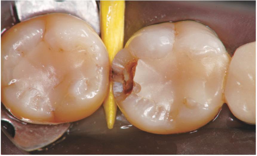 スクリーンショット 2017 01 13 2 26 27