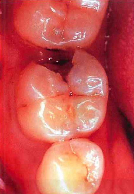 スクリーンショット 2017 01 13 2 33 10