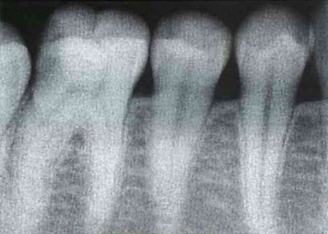 スクリーンショット 2017 01 13 2 33 14