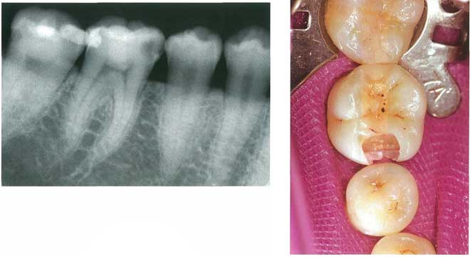 スクリーンショット 2017 01 13 2 40 08