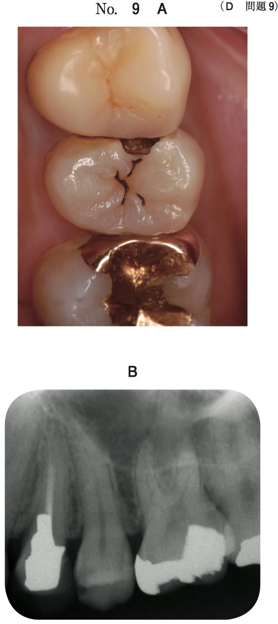 スクリーンショット 2017 01 18 1 19 46