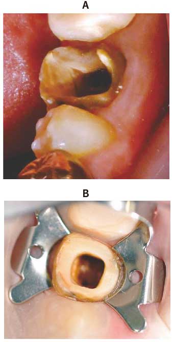 隔壁形成写真 80