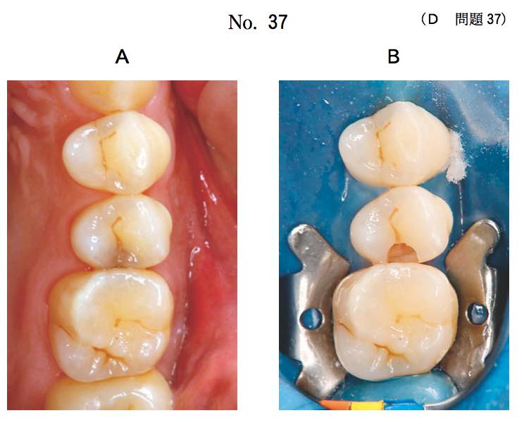 スクリーンショット 2017 01 11 19 24 42