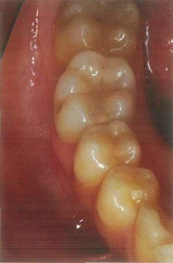 スクリーンショット 2017 01 19 16 04 58