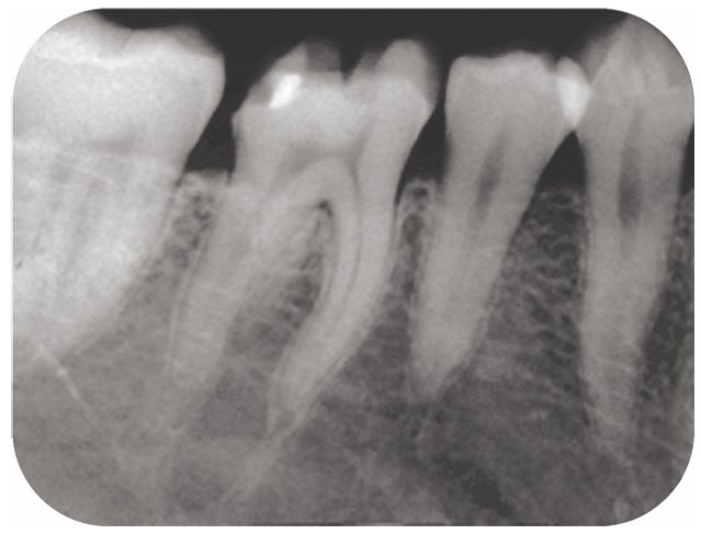 スクリーンショット 2017 01 19 16 07 27