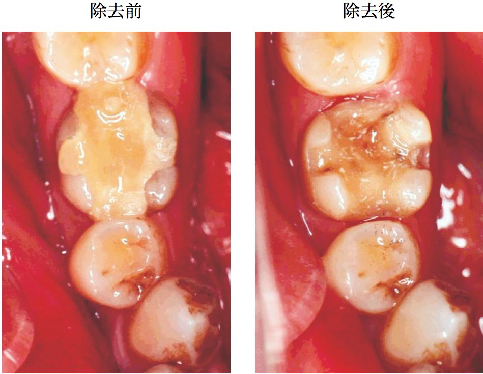 スクリーンショット 2017 01 19 16 07 34