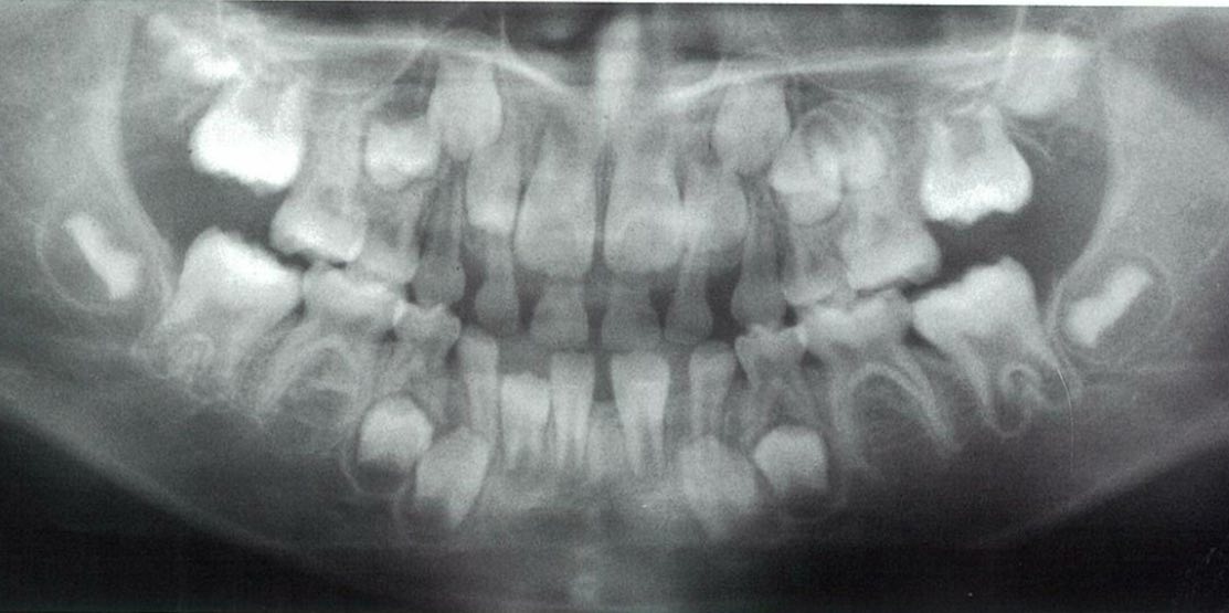 スクリーンショット 2017 01 31 11 14 40