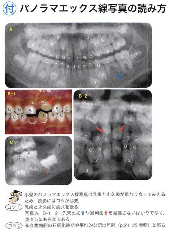 スクリーンショット 2017 01 31 14 58 32